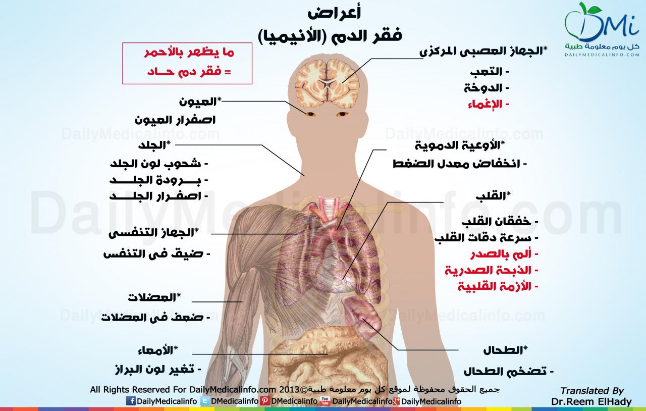 علامات فقر الدم 7939