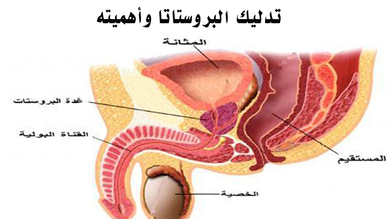 علاج البروستاتا عند الرجال , التهابات وامراض البروستاتا واساليب علاجها