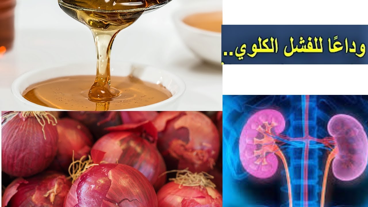 علاج الفشل الكلوي , افضل علاج لمرض الفشل الكلوي