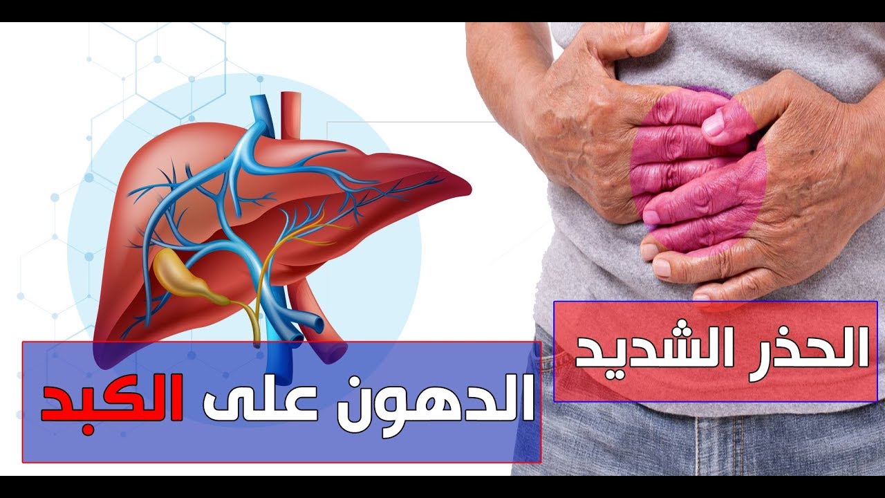 دهون الكبد وعلاجها 7867 1