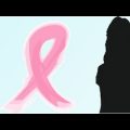 Unnamed File 74 اعراض سرطان الثدي - فيديو طبي يشرح الاعراض الملفتة لسرطان الثدي ثروت اصالة