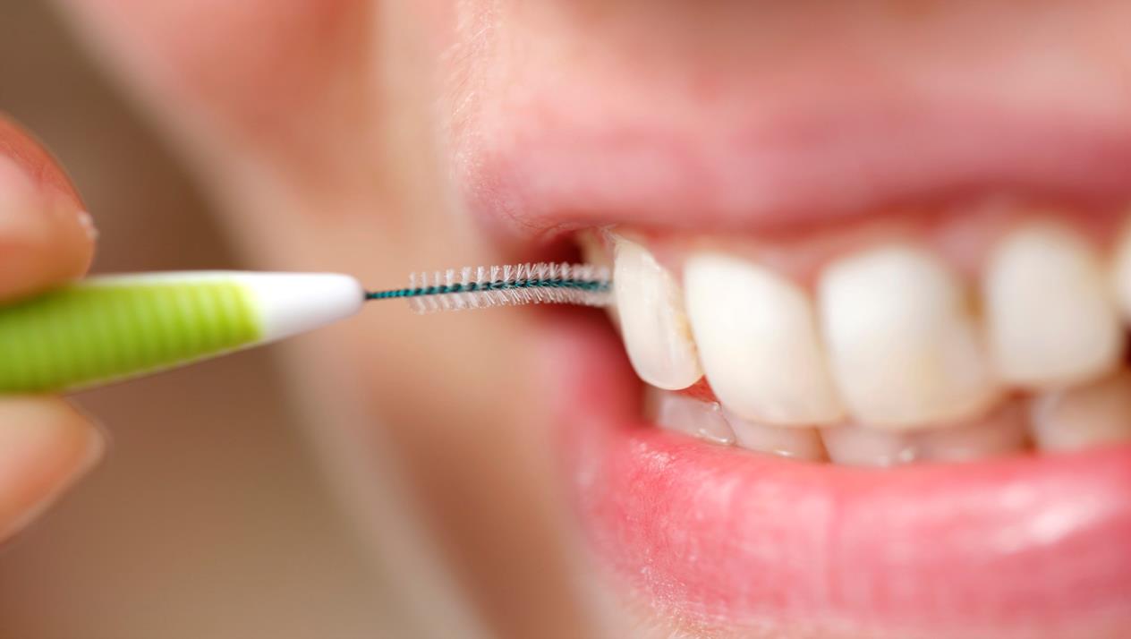 8447 نصائح بعد تنظيف الاسنان من الجير - افضل الوسائل للحفاظ على الاسنان بعد الجير عاقل كفوري