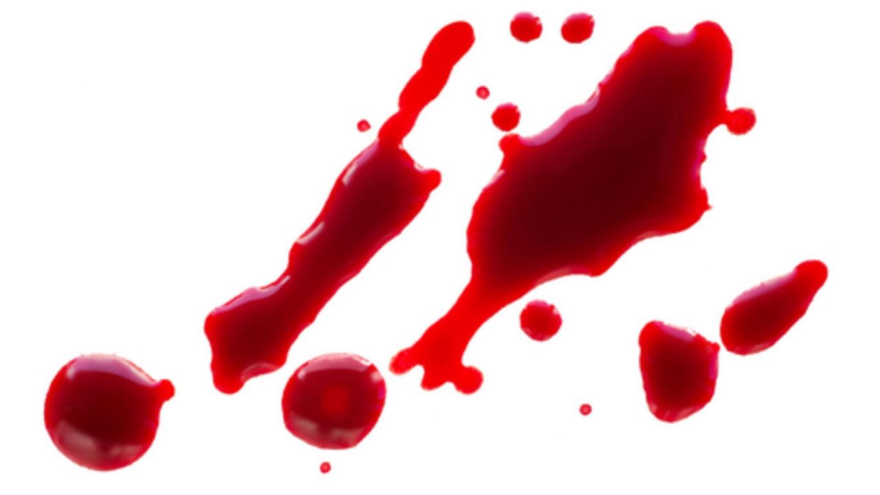 7718 13 الفرق بين دم الدورة ودم الحمل بالصور - ماذا تعرف عن دم الدورة و دم الحمل سندريلا داهي