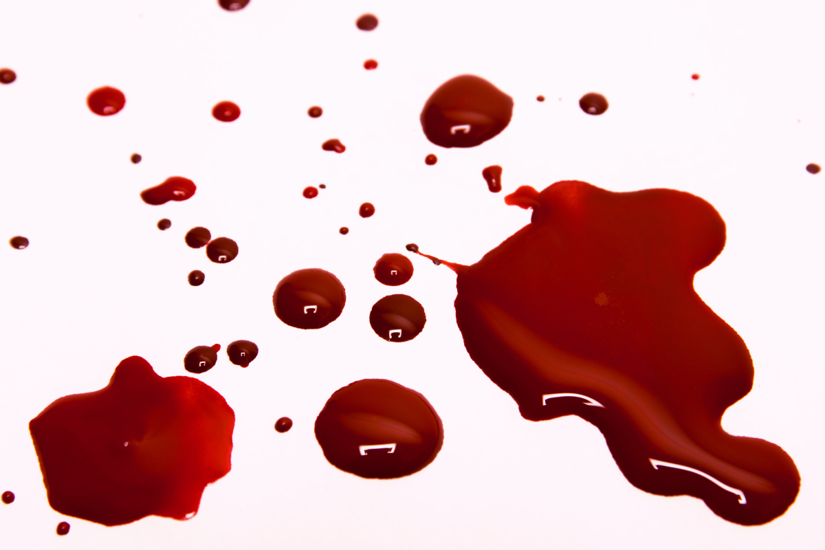 7718 5 الفرق بين دم الدورة ودم الحمل بالصور - ماذا تعرف عن دم الدورة و دم الحمل سندريلا داهي