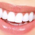 2259 2 علاج وجع الاسنان - كيف تعالج اسنانك وتهتم بها عاقل كفوري